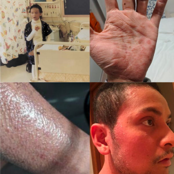 blog-thumbnail
